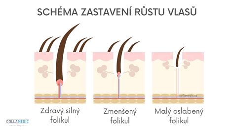 Schéma prierezu vlasu: porovnanie rovného (kruhový prierez), vlnitého (eliptický prierez) a kučeravého vlasu (ľadvinovitý prierez).