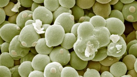 Mikroskopický snímok Saccharomyces cerevisiae.