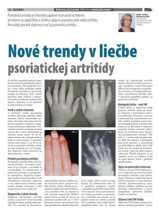 Infografika: Prehľad ochorení nechtov a ich prejavov