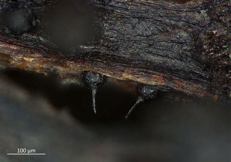 Mikroskopický pohľad na plodničky a spóry huby <em>Guignardia bidwellii</em>