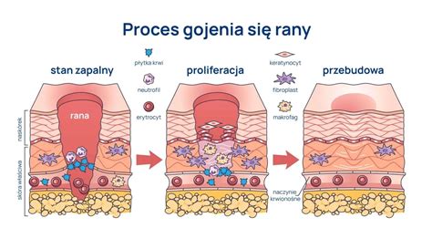 Infografika správneho ošetrenia rany na kmeni: čistenie nožom, aplikácia fungicídu a následné zatretie štepárskym voskom