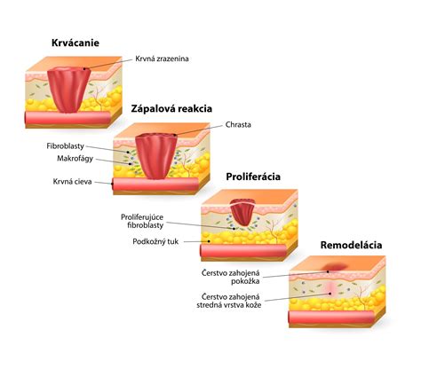 Infografika zobrazujúca hlavné oblasti použitia dubovej kôry: pleť, trávenie, hemoroidy a hojenie rán