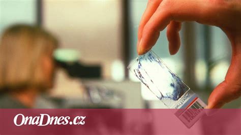 Ilustrácia alebo fotografia Rozpuku jedovatého s varovným symbolom