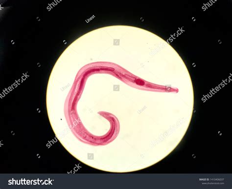 Ilustrácia parazita mrle detskej (Enterobius vermicularis) pri pohľade pod mikroskopom
