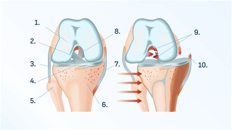 Schéma prípravy odrezku: šikmý rez pod púčikom a rovný rez nad horným púčikom