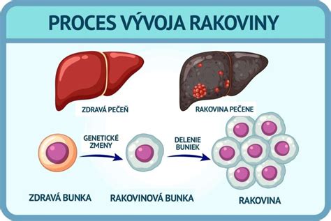 Schéma funkcií pečene v ľudskom tele a proces filtrácie toxínov