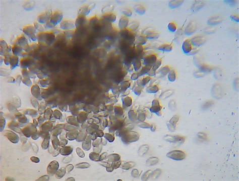 Mikroskopická fotografia cýst črievičky veľkej