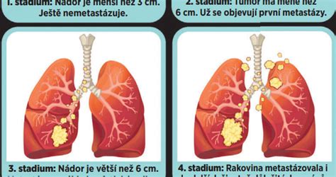 Detail poškodenej kôry gaštana s príznakmi rakoviny