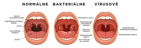 Tematická fotografia marhúľ s viditeľnými príznakmi chrastavitosti