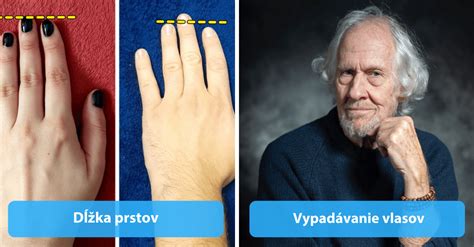 Schéma rozdielov medzi bylinnou a drevitou pivóniou