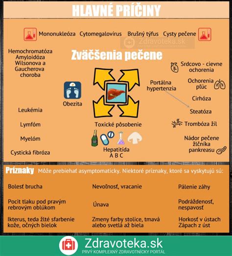 Infografika zobrazujúca príznaky preliatia a nedostatočnej zálievky antúrie