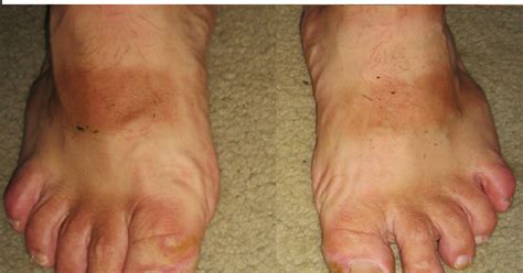 Foto chodidla v miske s teplou vodou a mydlom pred pedikúrou