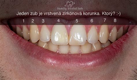 Schéma: Rozdiel medzi kmeňom juky a palmou, ilustrácia správneho rezu pri rozmnožovaní.