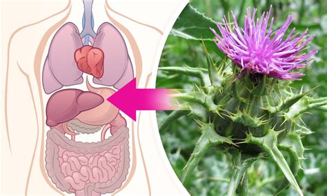 Schéma výsadby pestreca mariánskeho v záhrade