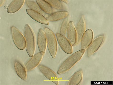 Schéma životného cyklu huby Venturia pirina a jej šírenia na hruške počas vegetačného obdobia