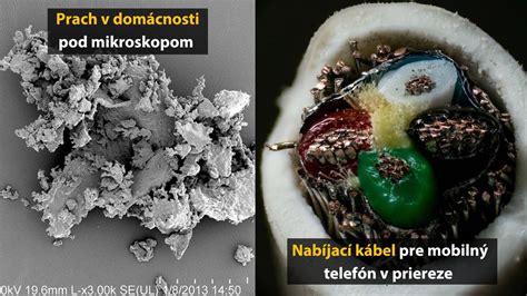 Detailný pohľad na štruktúru huby Botrytis cinerea pod mikroskopom.