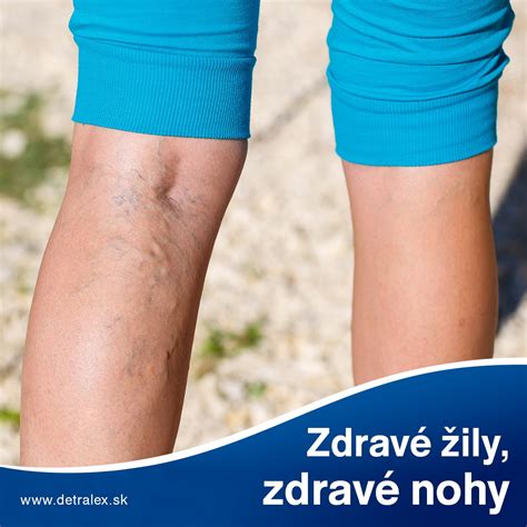 Detail listov pažítky s príznakmi vošiek alebo hrdze