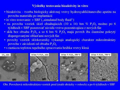 Schéma fáz pučania kôstkovín (od fenofázy včelieho púčika po kvitnutie) s vyznačením ideálnych termínov pre rôzne druhy postrekov