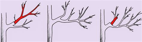 Ilustrácia správneho uhla kostrových konárov broskyne