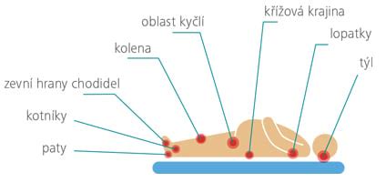 Schéma znázorňujúca anatómiu pier a miesta vzniku ragád (kútikov)