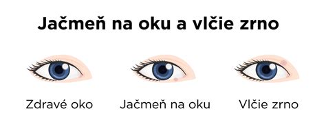 Infografika zobrazujúca podiel jednotlivých plodín (pšenica, kukurica, jačmeň) na celkovej produkcii obilnín v EÚ.