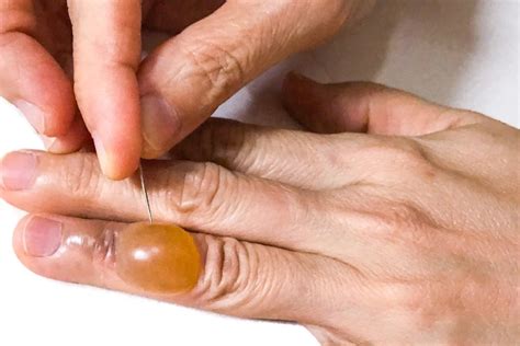 Ilustrácia prípravkov na ošetrenie pokožky pri ovčích kiahňach