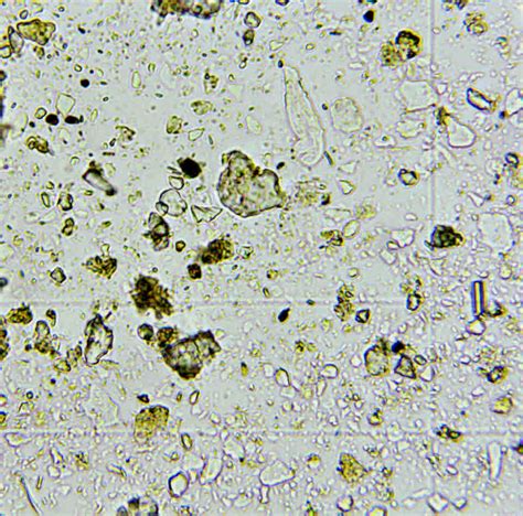 mikroskopický pohľad na život v zdravej pôde