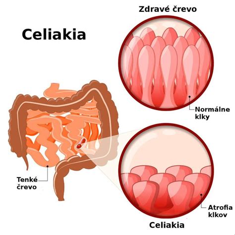 Anatomické znázornenie žlčníka a jeho vzťahu k pečeni a tenkému črevu