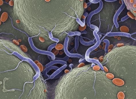 Mikroskopický záber cyklopa