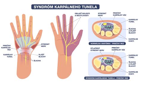 Infografika zobrazujúca tri metódy štepenia: do rázštepu, očkovanie a kopulácia s vyznačením smeru rezov