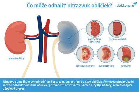 anatomická schéma močového ústrojenstva s vyznačením obličiek