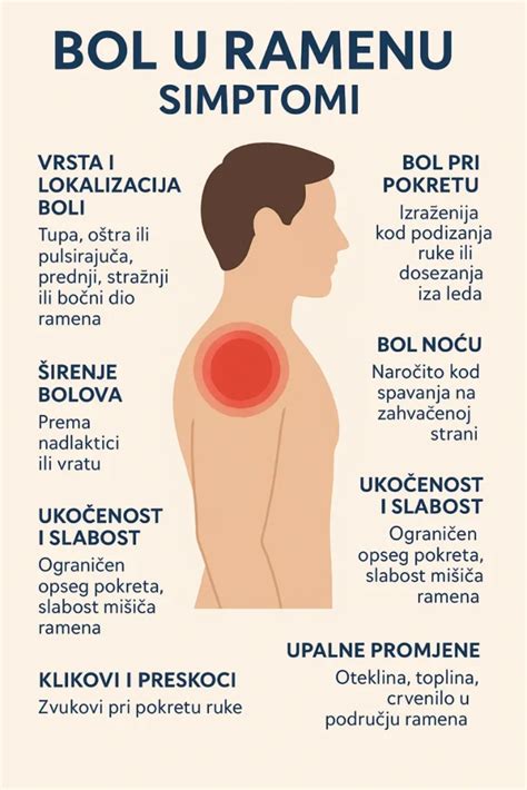 Ilustrácia mechanického ramena herného automatu