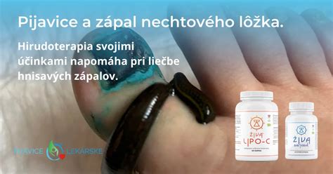 Schematické znázornenie anatómie pijavice lekárskej s vyznačenými orgánmi