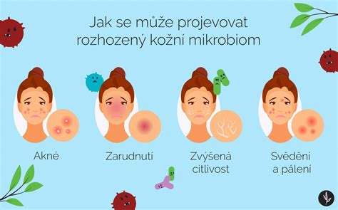 Infografika zobrazujúca proces hydratácie pokožky termálnou vodou a jej minerálmi