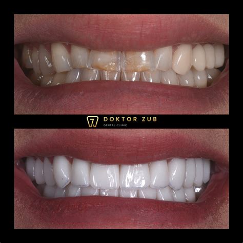 Estetický vzhľad hlohyne počas roka