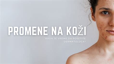 Ilustrácia svrabových chodbičiek na koži