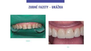 ukážka iberky pred a po zostrihaní