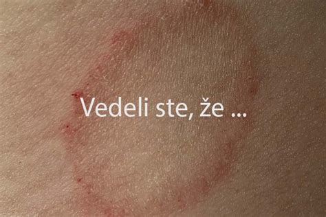 detailný záber na hnednutie ihličia spôsobené hubovou infekciou