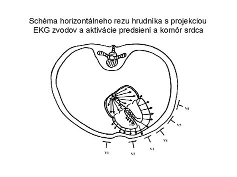 Schéma správneho rezu vresu