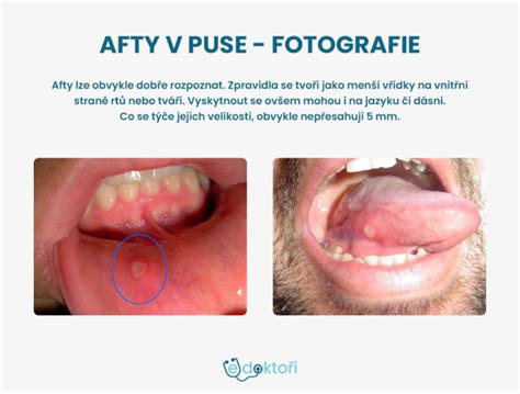 Infografika znázorňujúca starostlivosť o ikry: od penových hniezd až po nosenie v ústach