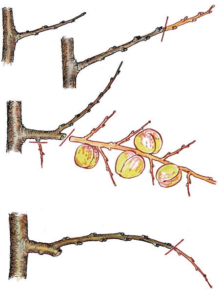 ilustrácia postupu Lorettovho rezu (krátky rez)