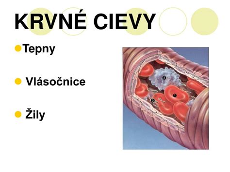 Schéma: Prierez pokožkou znázorňujúci rozšírené krvné cievy (teleangiektázia) pod povrchom pleti.