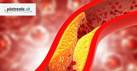 schéma znázorňujúca vplyv beta-glukánov na znižovanie cholesterolu v tenkom čreve