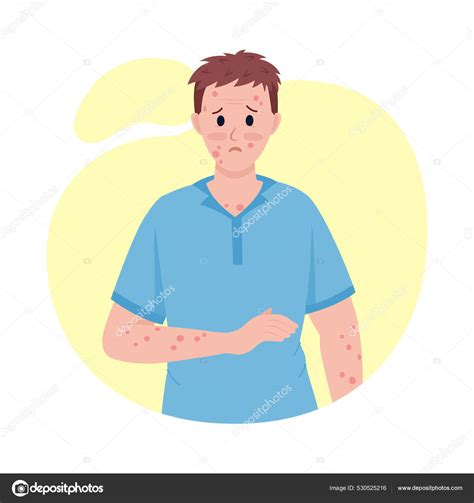 ilustrácia dieťaťa s charakteristickou vyrážkou na trupe