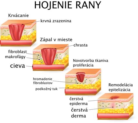 Detailná schéma správneho rezu vetvy za golierom, ktorý podporuje rýchle hojenie rany.