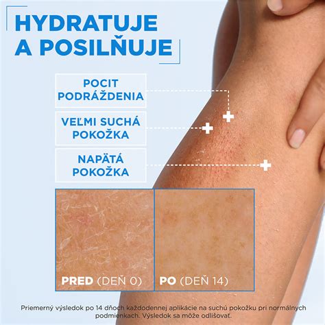 náplasťový test na alergickú dermatitídu