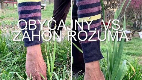 Porovnanie planého výhonu a odrodového výhonu ruže